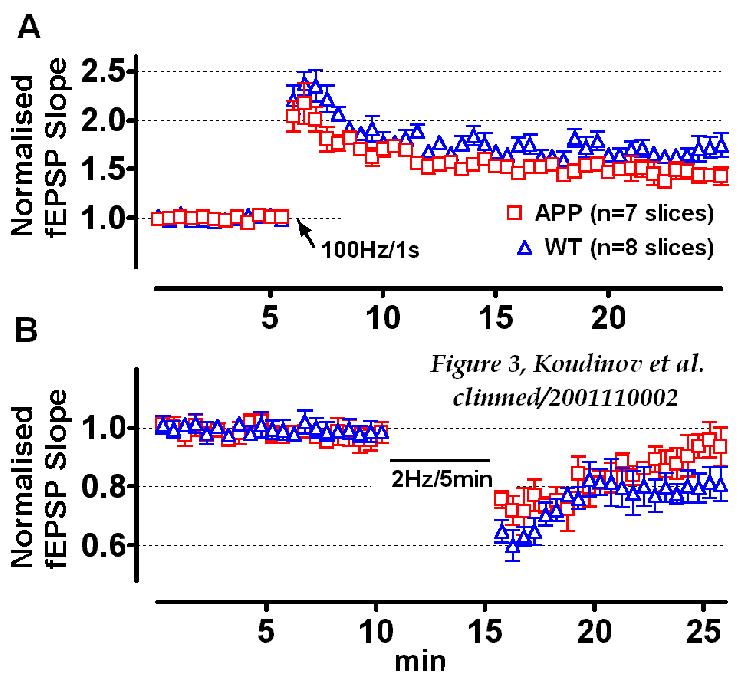 Figure 3: Electrophysiological analysis of 16.5 month old  APP transgenic mice